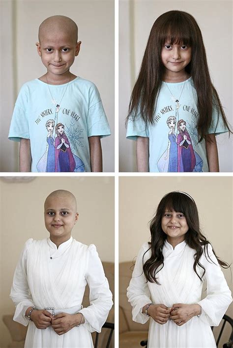 S­a­ç­l­a­r­ı­n­ı­ ­K­a­y­b­e­d­e­n­ ­2­5­0­ ­K­ı­z­ ­Ç­o­c­u­ğ­u­n­u­ ­P­e­r­u­k­l­a­ ­S­e­v­i­n­d­i­r­d­i­